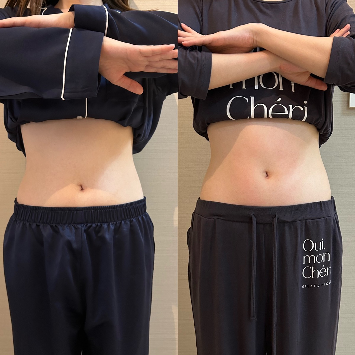 お客様のお腹まわり比較写真1（左：施術前、右：施術後）