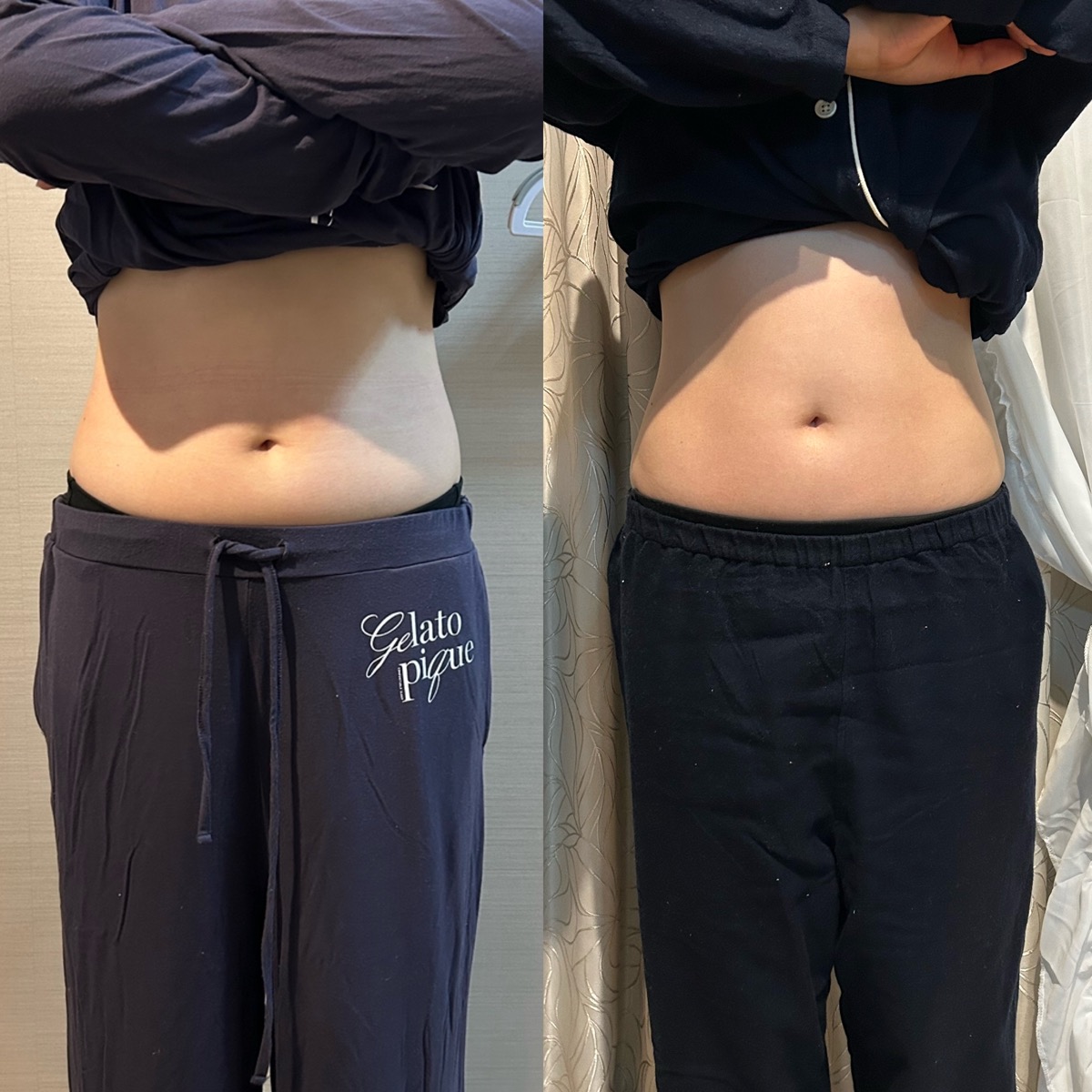 お客様のお腹まわり比較写真3（左：施術前、右：施術後）